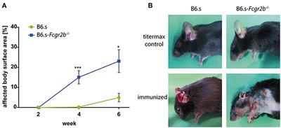 Fcγ Receptor IIB Controls Skin Inflammation in an Active Model of Epidermolysis Bullosa Acquisita